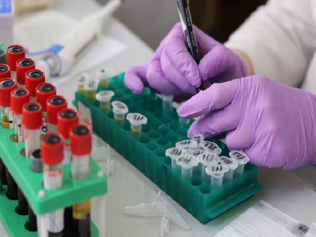 Reliance develops RT-PCR kit that gives COVID-19 results in 2 hours